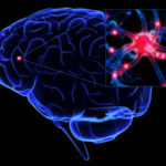 When your brain is sick you don't feel pain.